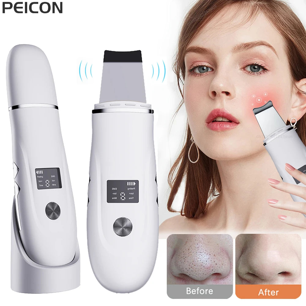 VitaClean Ultrasonic Scrubber – Deep Cleansing & Pore Refining Facial Spatula