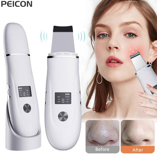 VitaClean Ultrasonic Scrubber – Espátula facial para limpeza profunda e refinamento de poros